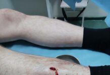 У адвоката Александра Немова рана в ноге, предположительно, ее нанесли ударом ножа. Фото опубликовано с его согласия