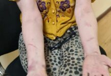 Альфия Салахова заявила об издевательствах в полиции