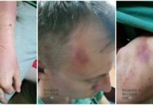 Фигурант дела о поджоге буквы Z в Белгороде заявил о пытках и втором уголовном деле против него