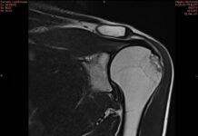 «Открывай машину, сука! Открыл быстро! Открывай, блять!», — уличный художник Philippenzo рассказал, как ему сломали плечо во время задержания в Москве