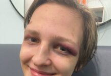 Сообщивший о пытках активист Денис Охрямкин покинул Россию