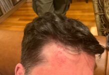 На Леонида Волкова совершено нападение, сообщили его соратники