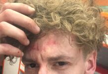 На главу калужского предвыборного штаба Бориса Надеждина совершили нападение