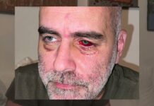 «Я услышал как один из них закричал: “Убейте его!” И кто-то начал душить меня моим же шарфом». Интервью с Давидом Кацаравой