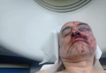 Лидер оппозиционного движения «Сила в единстве» в Грузии находится в реанимации после избиения спецназом