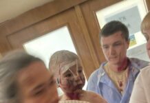 После ракетного удара в Киеве погибли не менее 10 человек, 35 ранены — Киевская городская военная администрация