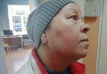 На 25 тысяч рублей оштрафовали чиновника, ударившего активистку, недовольную мусором на дороге